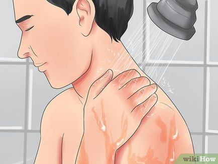 Hogyan lehet eltávolítani a benőtt szőrszálakat