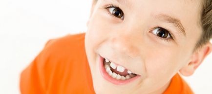 Hogyan, hogy összehangolják a fogak nélkül fogszabályozó, hogy lehet használni otthon