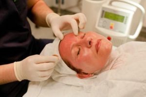 Hogyan fedezi fel pattanások az arcon krémek - részletes használati