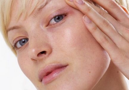 Bőrpír az arcon oka, hogyan kell eltávolítani bőrpír krémek, kenőcsök, stb