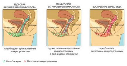 A szájpenész megelőzése és kezelése antibiotikum (kezelés) A szájpenész antibiotikumok megelőzésére és kezelésére