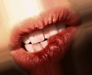 Miért harap az ajkak okoz a rossz szokások cikk