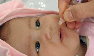 Polio okok, tünetek, kezelés, megelőzés