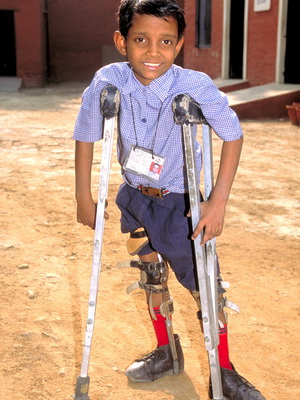 Polio esetek gyermekek fotó, jellemzői és okai A betegség szövődményei polio gyermekeknél