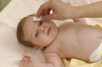 Egy újszülött hámló bőr ellátás, kezelés, akció