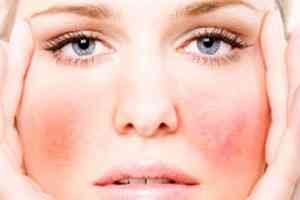 Allergiás az arc kezelés - a megfelelő arckezelés - cikkek Directory - hogyan lehet szép