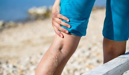 Flebolity a medence és a lábak okok, kezelés, a tünetek