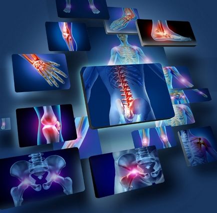 Hogyan lehet gyógyítani a betegséget elsődleges osteoarthritis modern módszerek kezelésére és megelőzésére