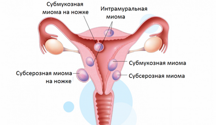 Havi hónapban az oka, hogy győződjön