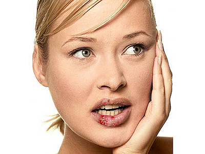 Miért száraz ajkak okoz szárazságot és a szájszöglet