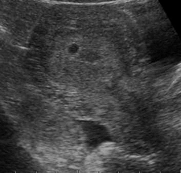 Ultrahang diagnosztika terhesség kis távon