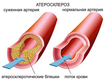 Vinpocetine olvasás használati utasítást, ár, analógok, véleménye (vinpocetine analógok) Vinpocetine olvasás használati utasítást, ár, analógok, vélemények
