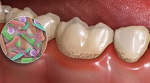 Fogorvos - eltér a fogorvos a fogorvos - Fogászati ​​portál