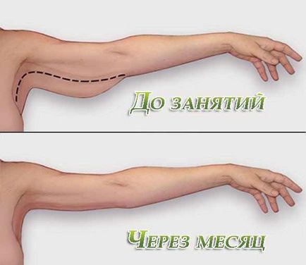 Mit kell tennie, hogy vékonyabb karok