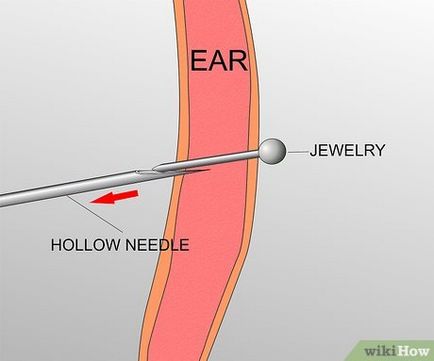 Hogyan átszúrja fül porc