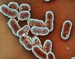 Baktériumtörzsek példái szükséges és az ember számára hasznos