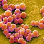 Hogyan lehet azonosítani a fertőző betegségek