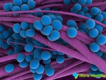 Staphylococcus aureus gyermekeknél - függetlenül attól, hogy veszélyes, és amikor szükséges ébreszteni