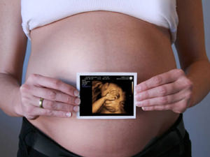 3D terhességi ultrahang látható és milyen feltételek jobb, hogy végezzen felmérést