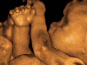 3D terhességi ultrahang látható és milyen feltételek jobb, hogy végezzen felmérést