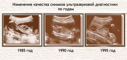 Terhesség és szülés, a Szovjetunió