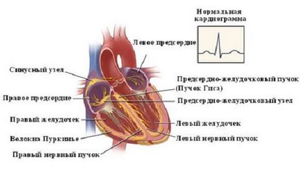 Bradycardia - okai, tünetei, tünetek és kezelés