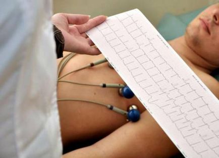 EKG szívinfarktus megfejtése jelek, lokalizáció