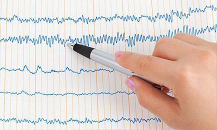 EKG gyermek 1 éves szabály ajánlások