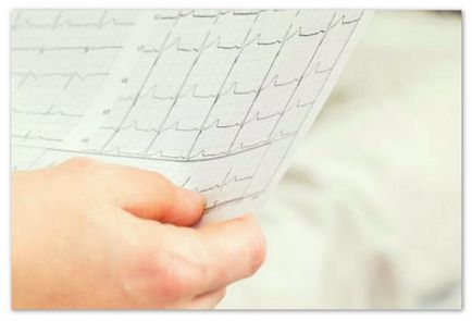 EKG gyermekeknél (ár) EKG gyermekeknél