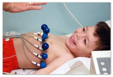 EKG gyermekeknél (átirat) EKG gyermekeknél