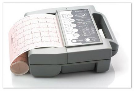 EKG gyermekeknél (szív) EKG gyermekeknél