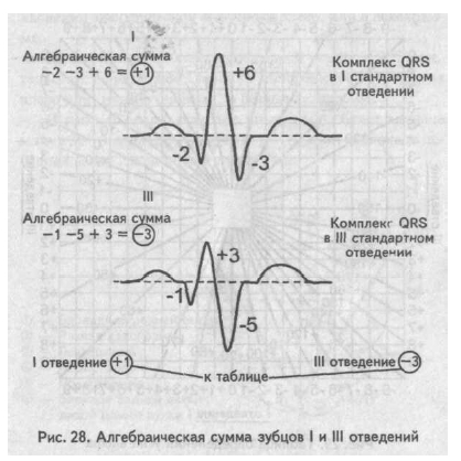 Eos (elektromos tengelye a szív) és a pozícióeltérés
