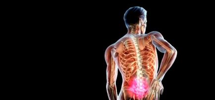 Spinal sérv tünetek és a kezelés, okok és a tünetek, fotók
