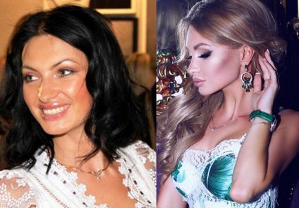 Mivel változatos Evgeny Gusev (Feofilaktova) előtt és után orrplasztika és mammoplasty - 300