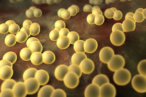 Hogyan kezelésére Staphylococcus aureus