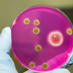 Hogyan kezelésére Staphylococcus aureus
