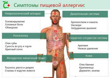 Hogyan lehet megkülönböztetni az allergia a hideg felnőttek és gyermekek, csecsemők, hogyan lehet meghatározni (határozza meg) Hogyan lehet megkülönböztetni az allergia a hideg felnőttek és gyermekek, csecsemők, hogyan lehet azonosítani