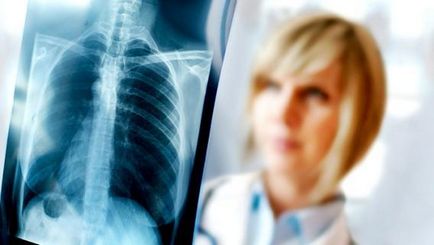 Hogyan adja át a mellkas röntgen ingyen, hogyan lehet egy ingyenes mellkas röntgen