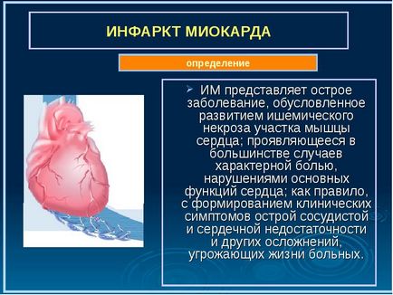 Hogyan ismerjük fel a szívinfarktus az EKG - dekódoló teljesítményét