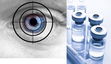 Cataract kezelése népi jogorvoslati otthon