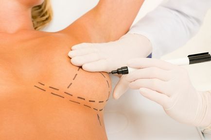 Reduction mammoplasty - mi ez, és milyen esetekben szükséges