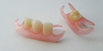 Nylon protetikai fogak részleges és teljes jellemzők és az árak