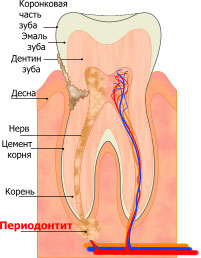 periodontitis kezelésében