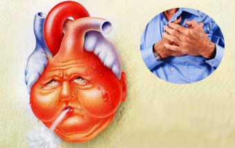 Szívelégtelenség tünetek a nők, a szív kezelés