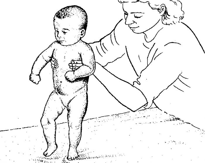 Tünetek és okok újszülöttkori hiper tartva, és a kezelési lehetőségek (masszázs, fürdők és
