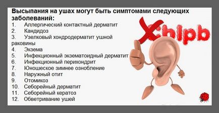 Kiütések a fülek (tinnitus kiütés) Kiütések a fülek