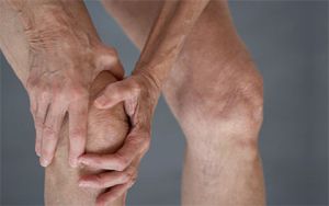Injekció (injekció) a térd osteoarthritis a térdízület termékek, szabályok, értékelés (injekciót a térdízület osteoarthritis gyógyszerek lelőtték a térd osteoarthritis a térd injekciók ízületek osteoarthritis injekciók gonarthrosis injekciót a térdízület arthrosis vélemény) Injekció (injekció) a térd osteoarthritis a térdízület termékek, szabályok, értékelés alapján