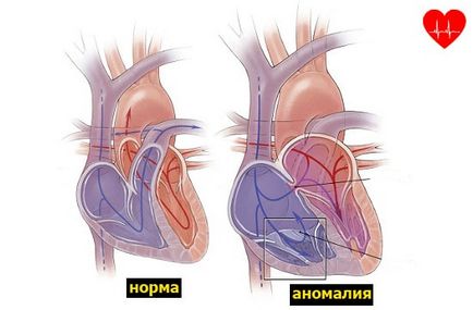 Hogyan lehet megtalálni a szívet Hogyan lehet megtalálni a szívet