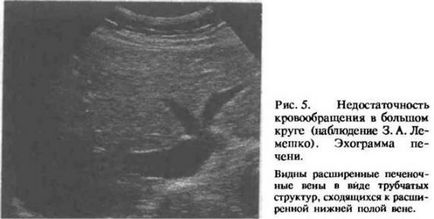 Hogyan lehet eltávolítani a fibroadenoma mell