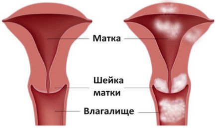 Abból, amit lehet véres váladék